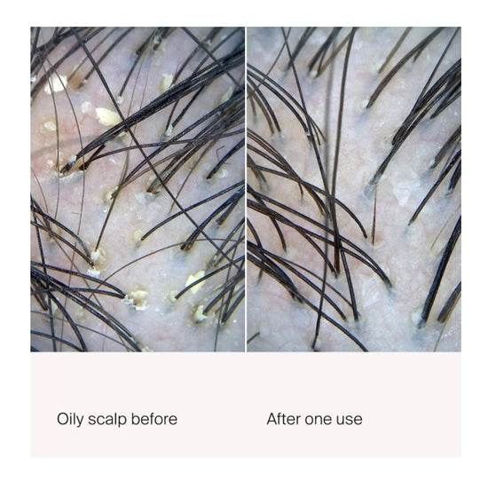 Exfoliator Living Proof
